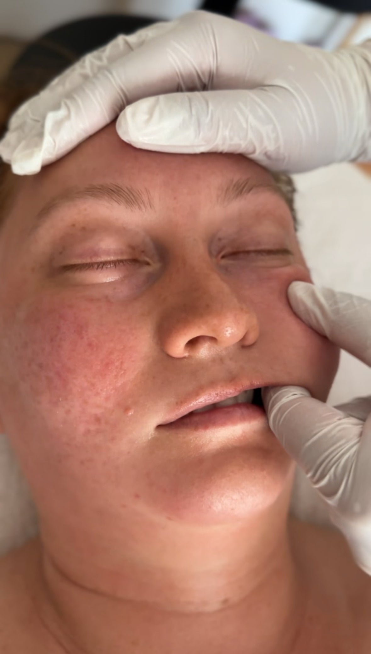 Buccal Massage Signature Facial | skin by sota